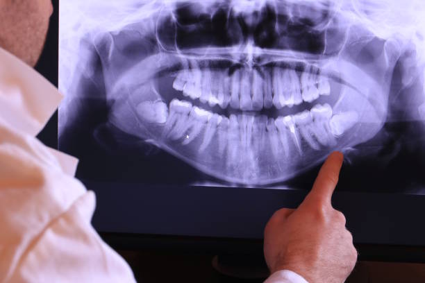 Best Emergency Denture Repair in Corning, CA